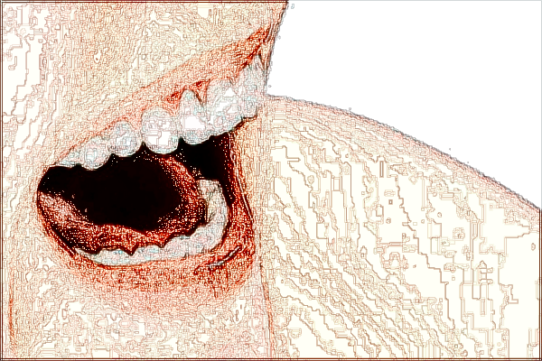 河北省口腔醫(yī)院烤瓷牙多少錢_烤瓷牙和全瓷牙的區(qū)別哪個(gè)好