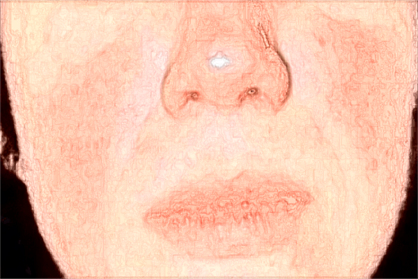 河科大二附院熱瑪吉做的好嗎?熱瑪吉內(nèi)部價格2024