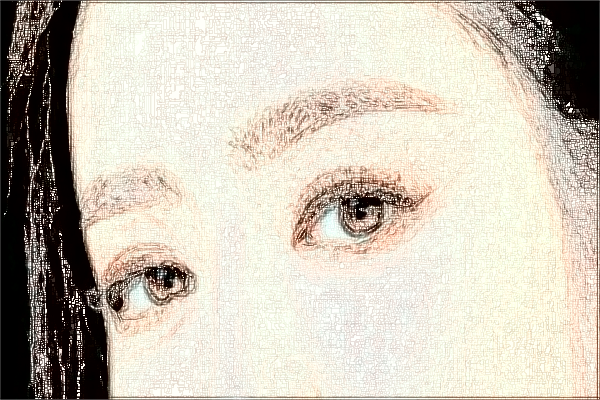 2024寧波市第一醫(yī)院激光祛斑做的好嗎_案例+價格