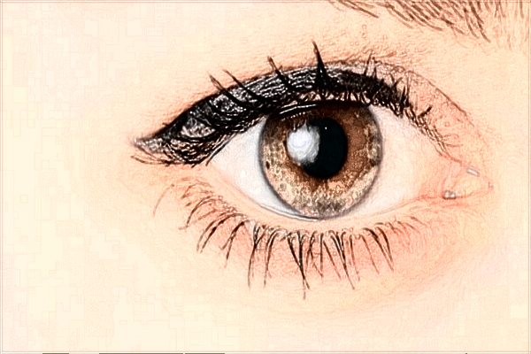 2024泰安市中醫(yī)二院眼角提升怎么樣?眼角提升價(jià)格公布