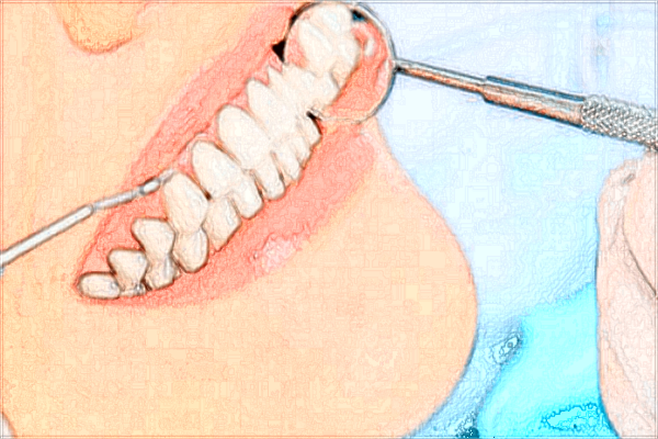 福建醫(yī)科大學(xué)附屬第二醫(yī)院牙科好不好?2024牙齒矯正價(jià)格曝光