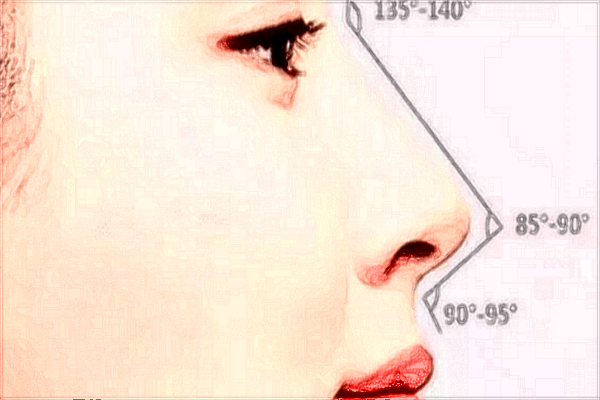 2024泰安市中醫(yī)二院做隆鼻價格_隆鼻可以只墊山根嗎