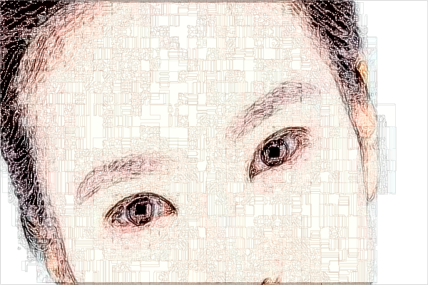 2024上海同濟醫(yī)院祛疤案例_做的怎么樣