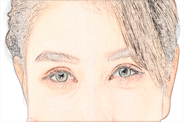 淮北市人民醫(yī)院祛痣多少錢【去痣案例】