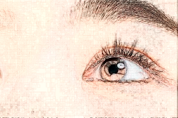 2024浙江省中醫(yī)院割雙眼皮價(jià)目表(價(jià)格表)怎么樣