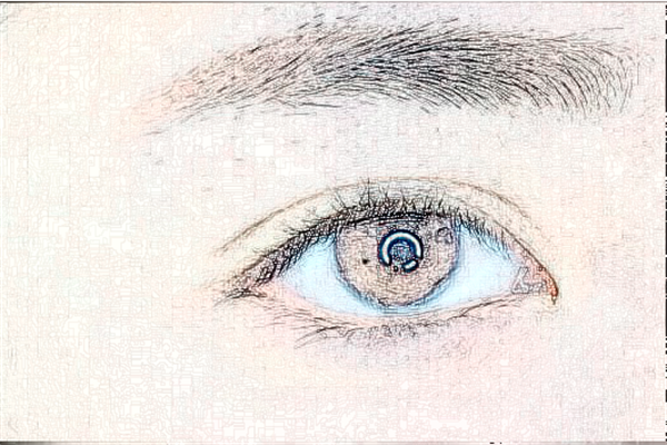 浙江省中醫(yī)院激光去黑眼圈好嗎?去黑眼圈會不會反彈