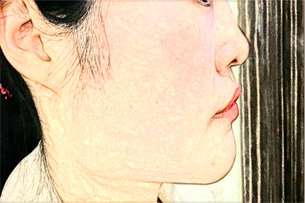 成都華西醫(yī)院祛斑價(jià)目表_祛斑后的注意事項(xiàng)有哪些