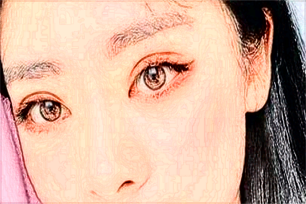 廣州華美玻尿酸怎么樣_玻尿酸填充臉部可以維持多久