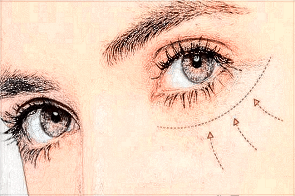 西安二院雙眼皮多少錢?2024西安二院雙眼皮價(jià)格表