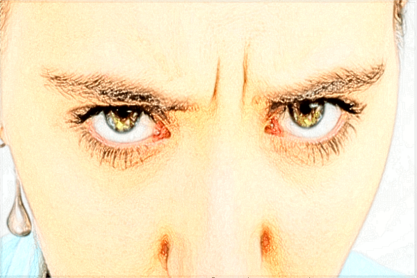 2024西安二院鼻骨矯正價(jià)格?鼻骨矯正手術(shù)有后遺癥嗎