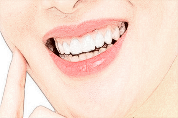 江蘇省口腔醫(yī)院做牙齒矯正怎么樣_哪個(gè)醫(yī)生做得好