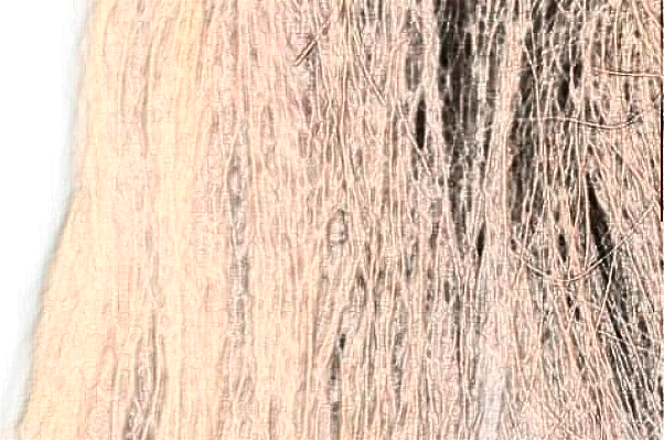 上海同濟(jì)醫(yī)院植發(fā)那個(gè)醫(yī)生做的好_做的怎么樣