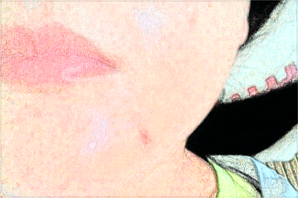 南昌大學(xué)第一附屬醫(yī)院祛痣掛什么科?2024祛痣價(jià)格