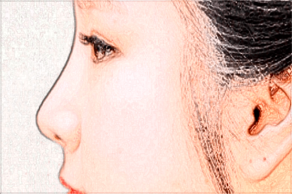 南昌大學(xué)第一附屬醫(yī)院去斑怎么樣?2024激光祛斑價格