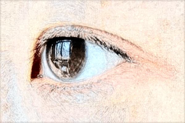 南昌大學(xué)第一附屬醫(yī)院雙眼皮手術(shù)醫(yī)生好嗎?2024雙眼皮多少錢