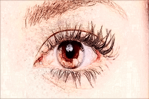 2024無錫市第二人民醫(yī)院去眼袋做的怎么樣_案例+價格