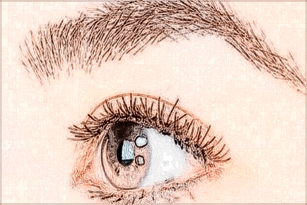 2024無錫市第二人民醫(yī)院去眼袋做的怎么樣_案例+價格