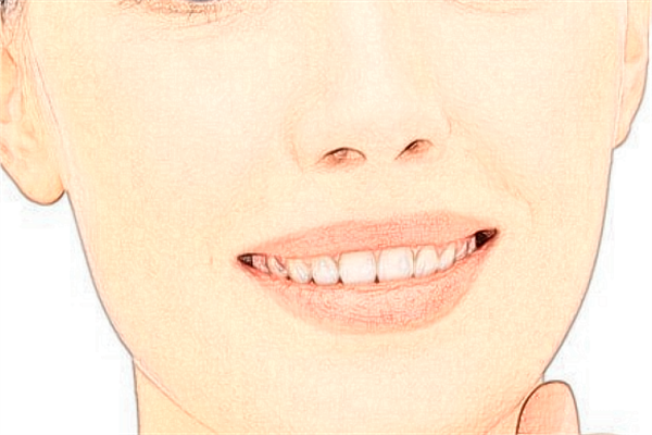 河北省人民醫(yī)院自體脂肪填充面部怎么樣_哪位醫(yī)生做的好