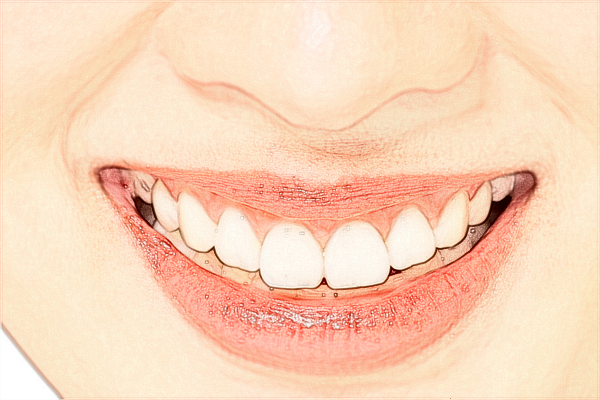 無錫市第二人民醫(yī)院口腔科牙齒矯正好的醫(yī)生有哪些