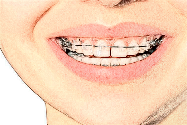 無錫市第二人民醫(yī)院口腔科牙齒矯正好的醫(yī)生有哪些