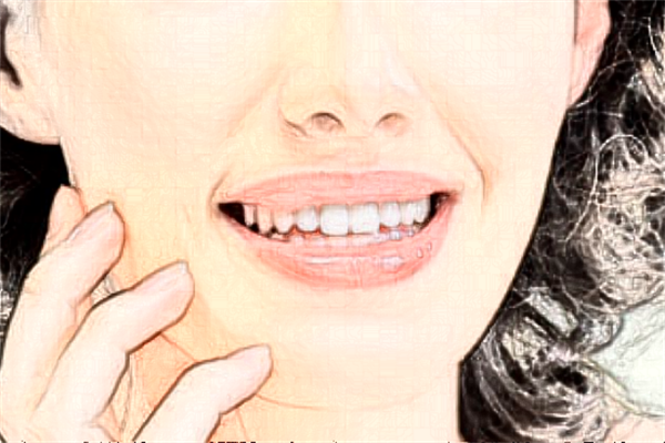 溫州醫(yī)學院附屬第一醫(yī)院去紅血絲價格多少_案例分享