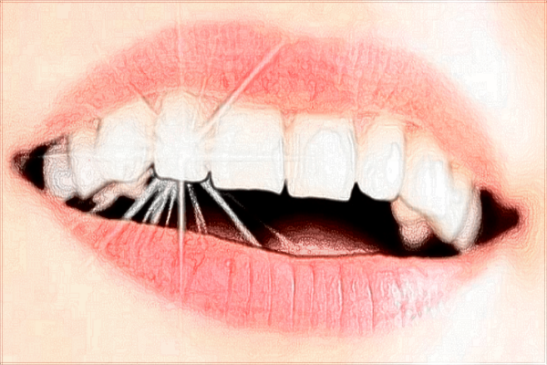 寧波李惠利醫(yī)院牙科醫(yī)生哪個(gè)好_價(jià)格貴不貴