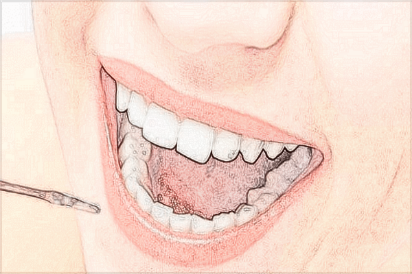 2024無錫市第二人民醫(yī)院口腔科哪個醫(yī)生好_價格貴不貴