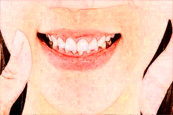 2024河北醫(yī)科大學(xué)第一醫(yī)院整牙做的好嗎?哪位醫(yī)生做的好