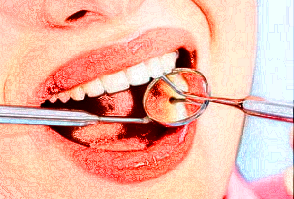 2024寧波市第一醫(yī)院牙科種植怎么樣【牙齒種植案例】