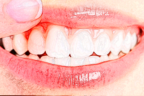 寧波市第一醫(yī)院補牙哪位醫(yī)生做的比較好_需要多少錢