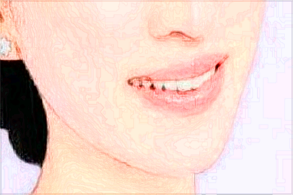 寧波市第一醫(yī)院祛痘價目表(價格表)怎么樣