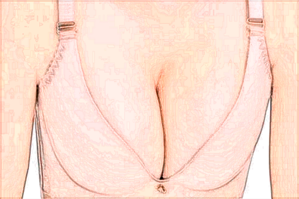 四川華西醫(yī)院隆胸做的好嗎?哪位醫(yī)生做的好