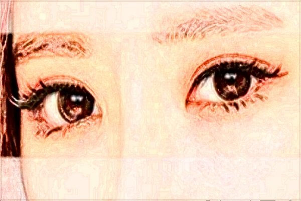 2024四川華西醫(yī)院割雙眼皮價格多少_做的怎么樣