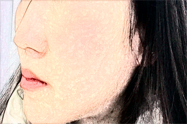 寧波市第一醫(yī)院脂肪填充怎么樣_做的好的醫(yī)生有哪些