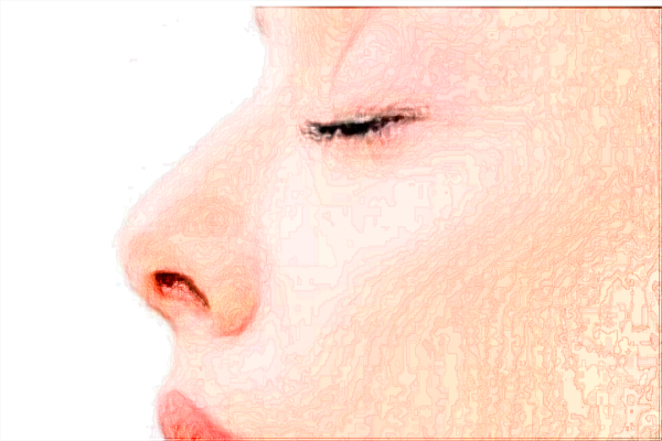 四川華西醫(yī)院激光美容價(jià)目表(價(jià)格表)怎么樣