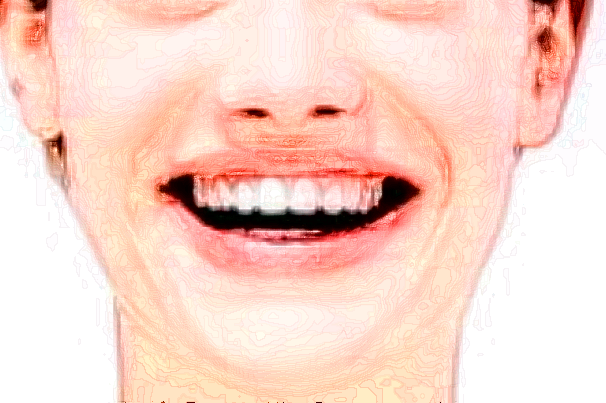 2024北京大學(xué)第一醫(yī)院補牙做的好嗎_哪位醫(yī)生做的比較好