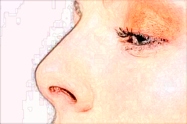 北京大學(xué)第一醫(yī)院整形科醫(yī)生名單簡介+價格