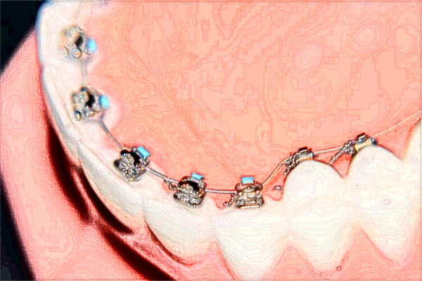 北京大學(xué)第一醫(yī)院口腔科那個醫(yī)生好+案例分享