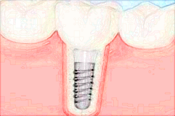 北京大學第一醫(yī)院口腔科王曉敏經(jīng)驗怎么樣_技術好不好