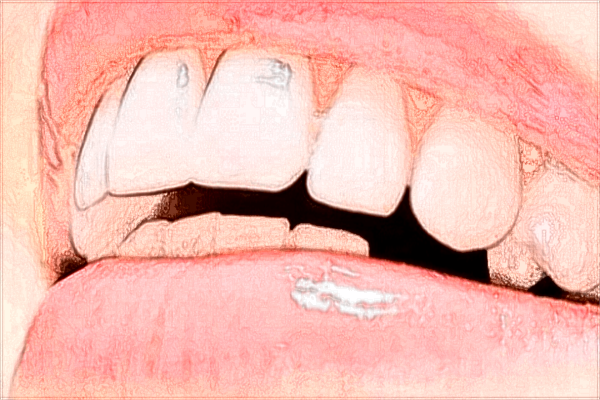 九江學(xué)院附屬醫(yī)院種植牙怎么樣?2024種植牙貴嗎?