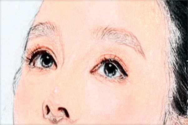 2024九江學(xué)院附屬醫(yī)院割雙眼皮多少錢?割雙眼皮恢復(fù)期是多久