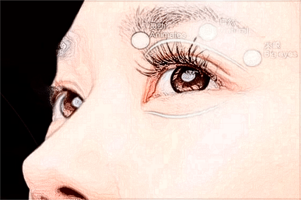 2024九江市中醫(yī)院近視手術(shù)收費價格?近視手術(shù)的利與弊