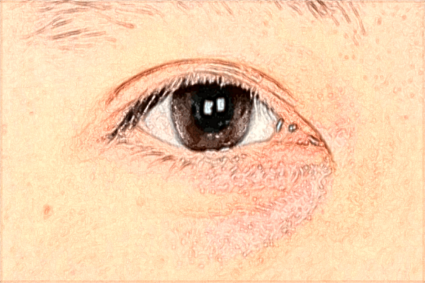 南昌大學(xué)第二附屬醫(yī)院祛斑怎么樣?2024激光祛斑需要多少錢