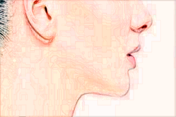 2024浙江省中醫(yī)院祛痘價(jià)目表(價(jià)格表)怎么樣