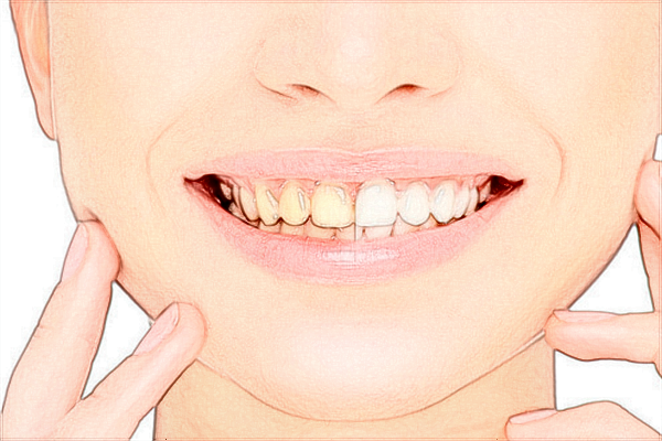 2024保定市第一中心醫(yī)院口腔科怎么樣_醫(yī)生名單