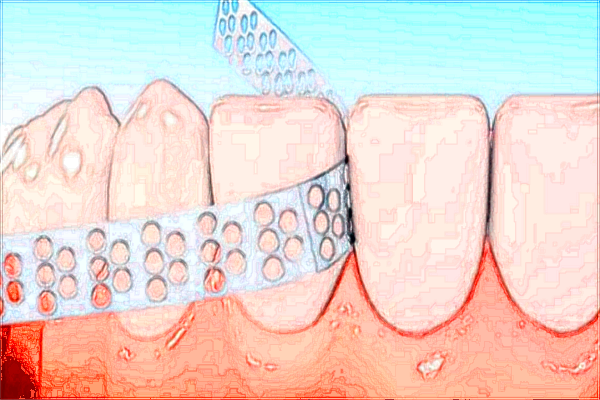 無(wú)錫市第二人民醫(yī)院牙科怎么樣_附醫(yī)生名單