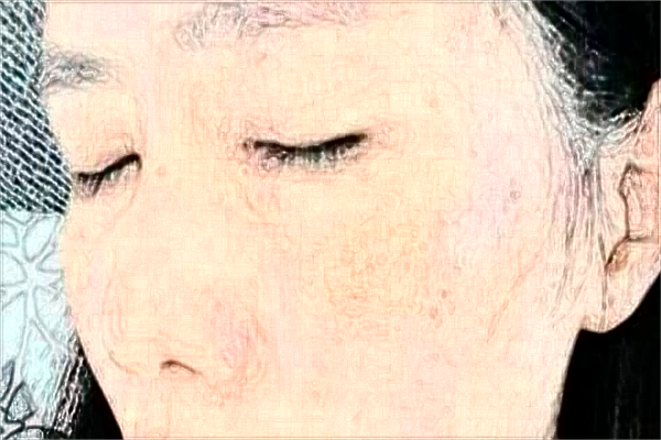 贛州市人民醫(yī)院激光祛斑好不好?2024激光祛斑的一般價格