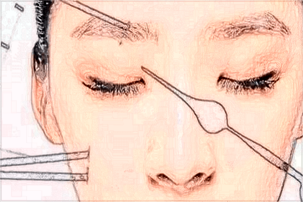 贛州市人民醫(yī)院激光祛斑掛哪個門診?激光祛斑多久能恢復