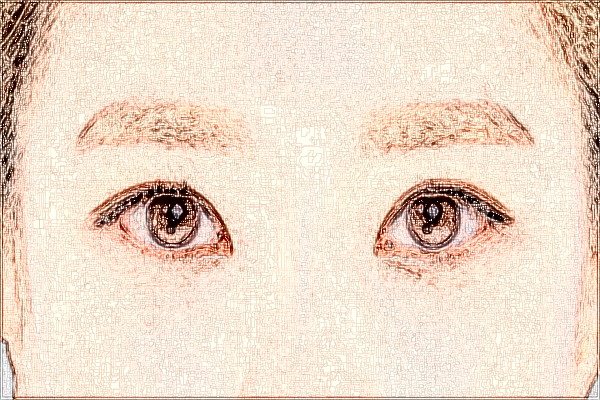 2024大連醫(yī)科大學(xué)附屬第一醫(yī)院去眼袋怎么樣_醫(yī)生技術(shù)好不好