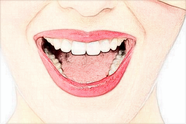 2024四川大學(xué)華西口腔醫(yī)院種植牙價(jià)格多少?種植牙案例分享